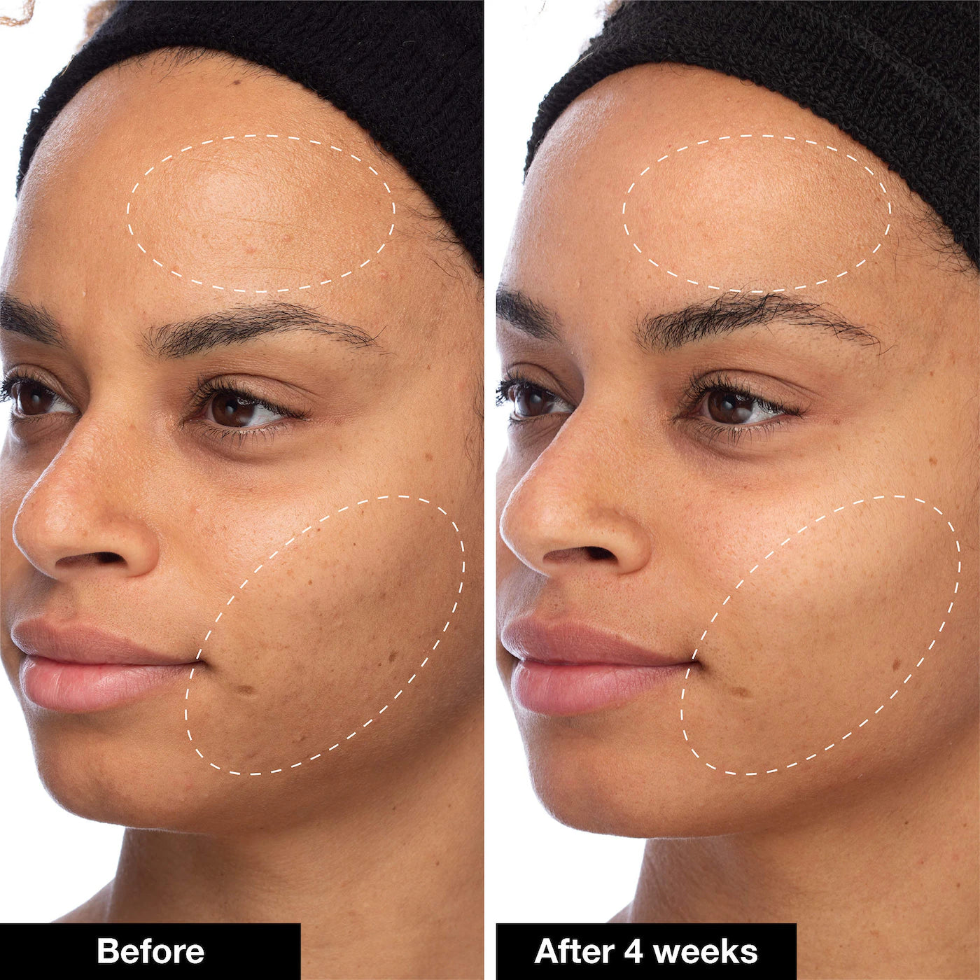 *PREORDEN: Slushy Serum - INNBEAUTY PROJECT / Suero hidratante