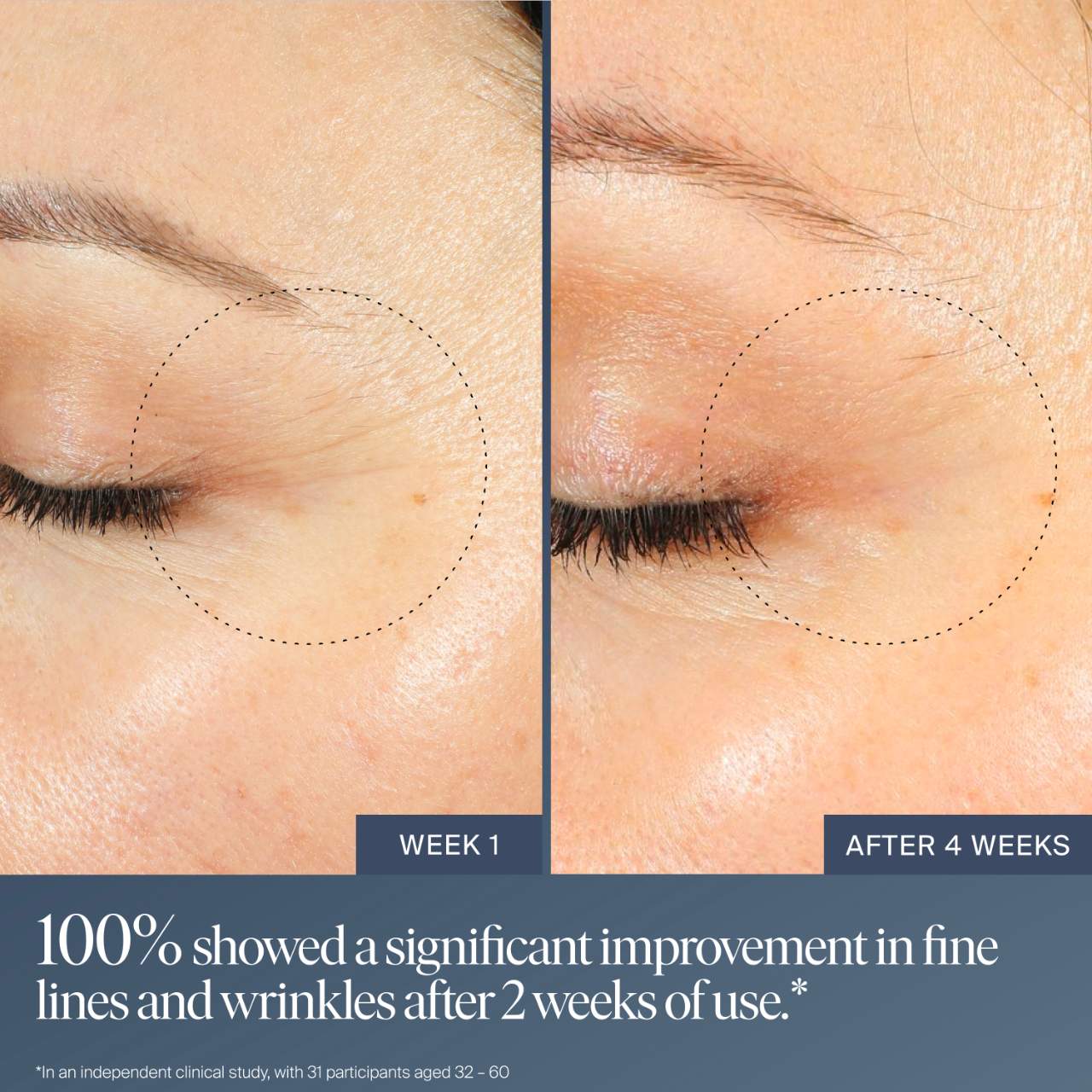 Jet Lag Overnight Eye Serum / Contorno de ojos para líneas finas y arrugas con retinol