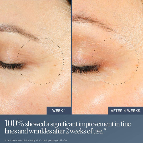 Jet Lag Overnight Eye Serum / Contorno de ojos para líneas finas y arrugas con retinol