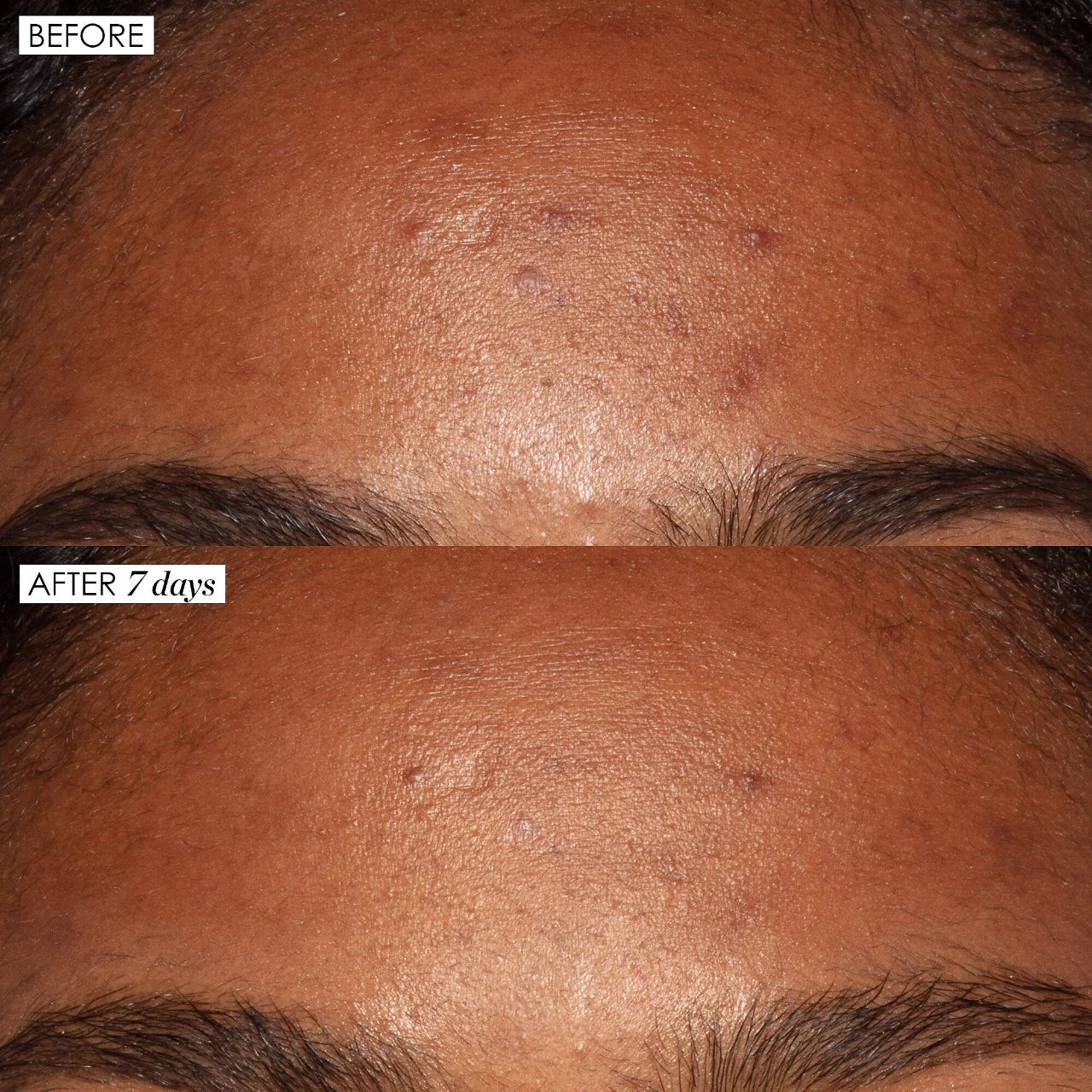 *PREORDEN: Good Genes All-In-One AHA Lactic Acid Treatment 30 mL - Sunday Riley  / Suero para poros, manchas oscuras y lineas de expresión