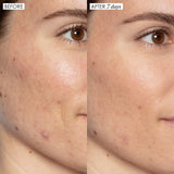 *PREORDEN: Good Genes All-In-One AHA Lactic Acid Treatment 30 mL - Sunday Riley  / Suero para poros, manchas oscuras y lineas de expresión