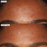 *PREORDEN: Good Genes All-In-One AHA Lactic Acid Treatment 30 mL - Sunday Riley  / Suero para poros, manchas oscuras y lineas de expresión