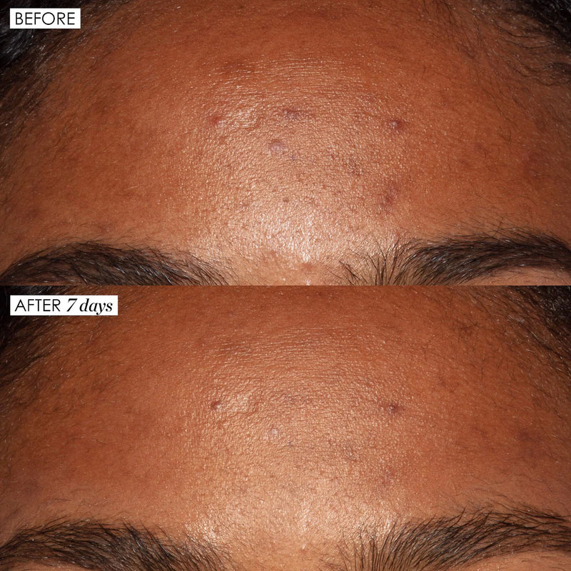 *PREORDEN: Good Genes All-In-One AHA Lactic Acid Treatment 30 mL - Sunday Riley  / Suero para poros, manchas oscuras y lineas de expresión