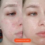 *PREORDEN: SOS Intensive Redness Relief Serum  59mL - Tower 28 / Suero calmante piel sensible