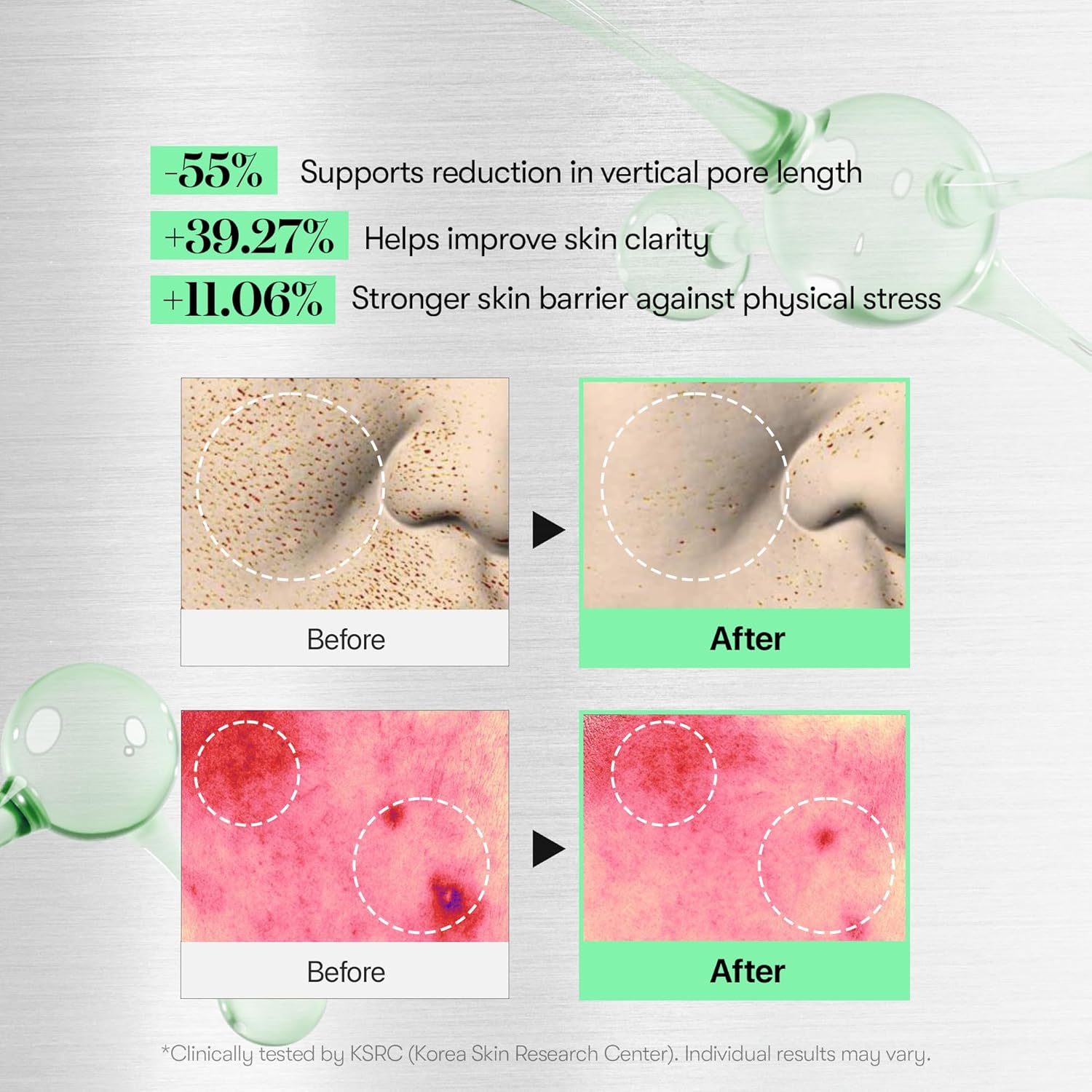 *PREORDEN: CICA Reedle Shot 100 - VT COSMETICS / Suero poros y textura de la piel