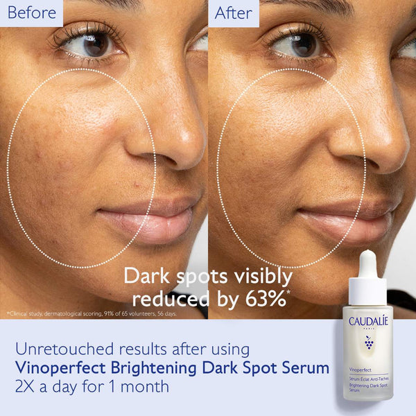 *PREORDEN: Vinoperfect Brightening Dark Spot Serum Vitamin C Alternative - Caudalie / Suero para combatir manchas e iluminar