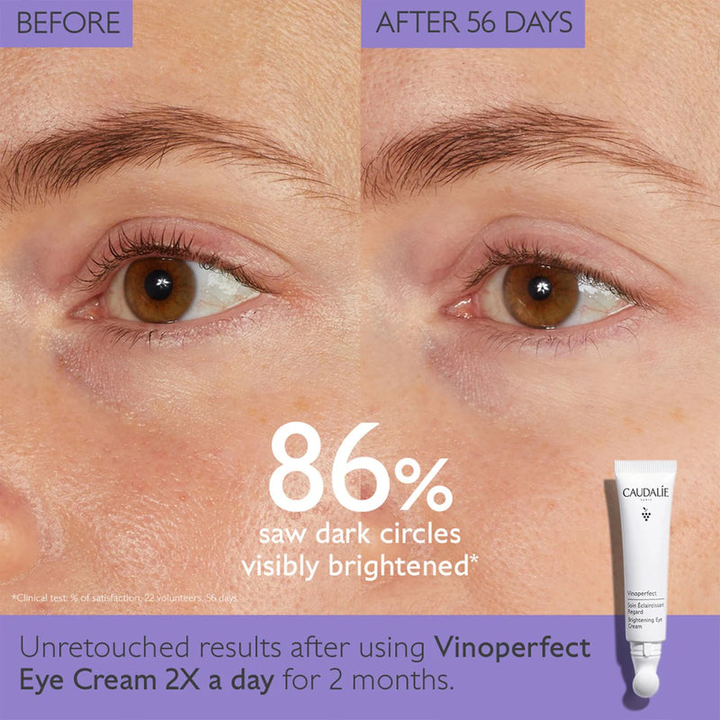 *PREORDEN: Vinoperfect Dark Circle Brightening Eye Cream with Niacinamide - Caudalie / Crema iluminadora de ojos para ojeras