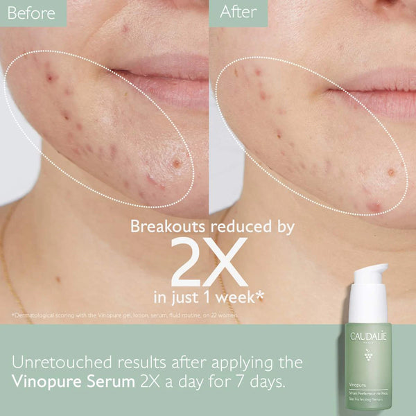 *PREORDEN: Vinopure Targets Acne-Prone Skin Set - Caudalie / Set para ácne absorbe grasa