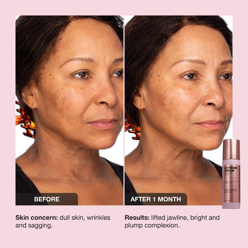 Extreme Cream Anti-Aging, Firming, & Lifting Refillable Moisturizer - iNNBEAUTY PROYECT / Crema para rostro reafirmante