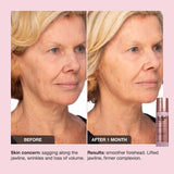 Extreme Cream Anti-Aging, Firming, & Lifting Refillable Moisturizer - iNNBEAUTY PROYECT / Crema para rostro reafirmante