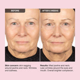 Extreme Cream Anti-Aging, Firming, & Lifting Refillable Moisturizer - iNNBEAUTY PROYECT / Crema para rostro reafirmante