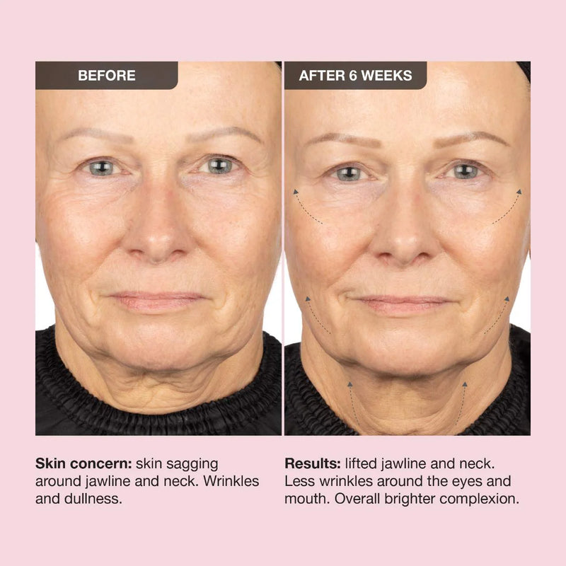 Extreme Cream Anti-Aging, Firming, & Lifting Refillable Moisturizer - iNNBEAUTY PROYECT / Crema para rostro reafirmante