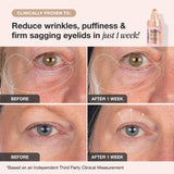 Extreme Cream Eye Firming & Contouring Refillable Eye Cream - iNNBEAUTY PROYECT / Crema de ojos para la hinchazón, arrugas y flacidez