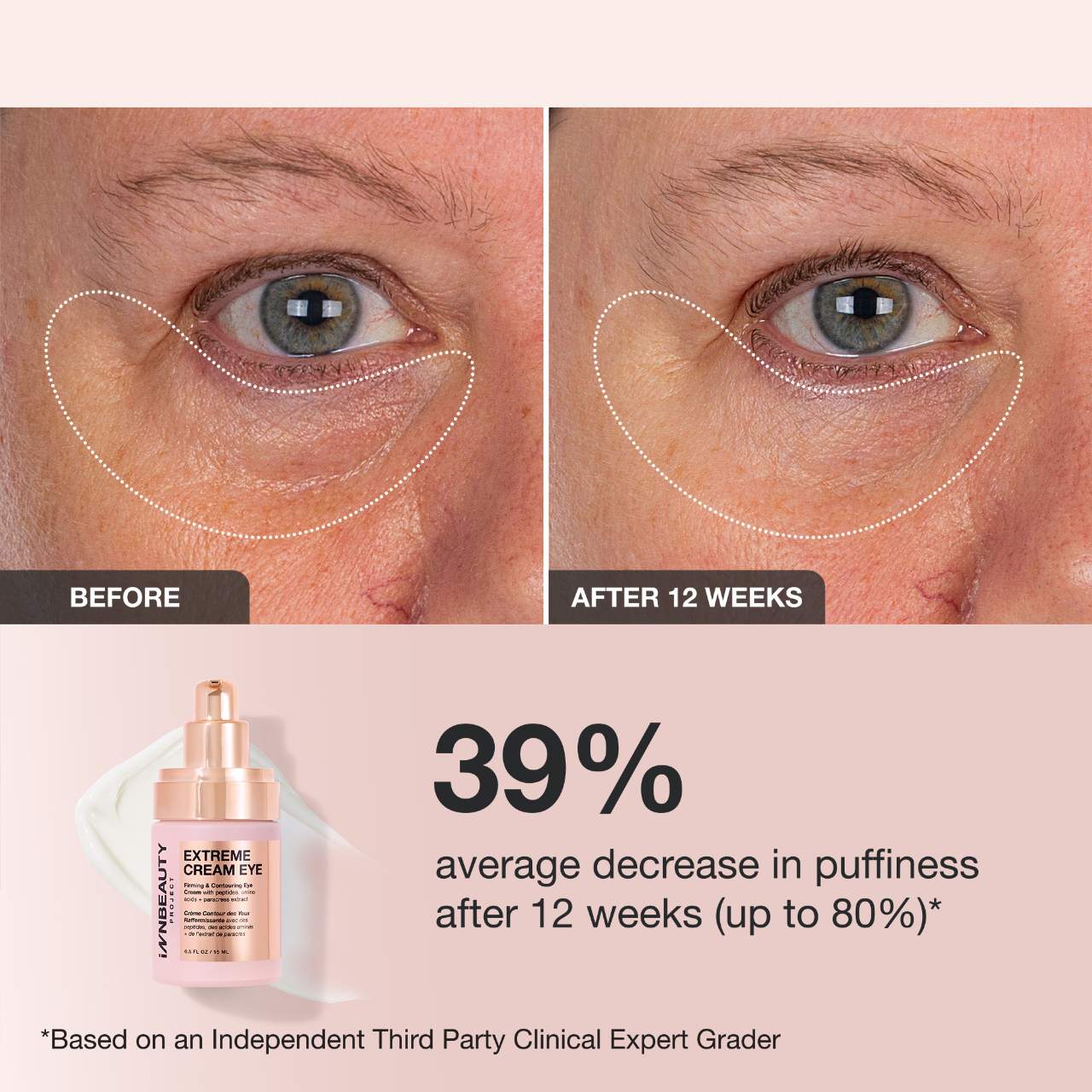 Extreme Cream Eye Firming & Contouring Refillable Eye Cream - iNNBEAUTY PROYECT / Crema de ojos para la hinchazón, arrugas y flacidez