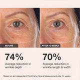 Extreme Cream Eye Firming & Contouring Refillable Eye Cream - iNNBEAUTY PROYECT / Crema de ojos para la hinchazón, arrugas y flacidez