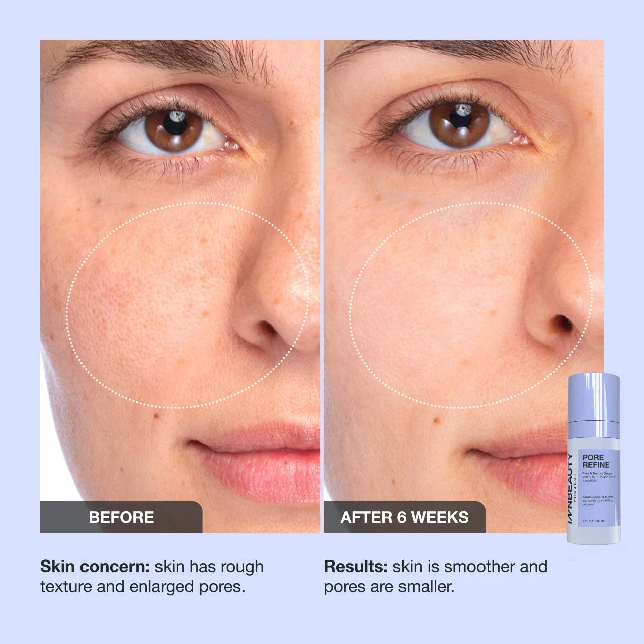 *PREORDEN: Refine AHA + BHA Texture & Pore Serum - iNNBEAUTY PROYECT / Suero para textura y poros