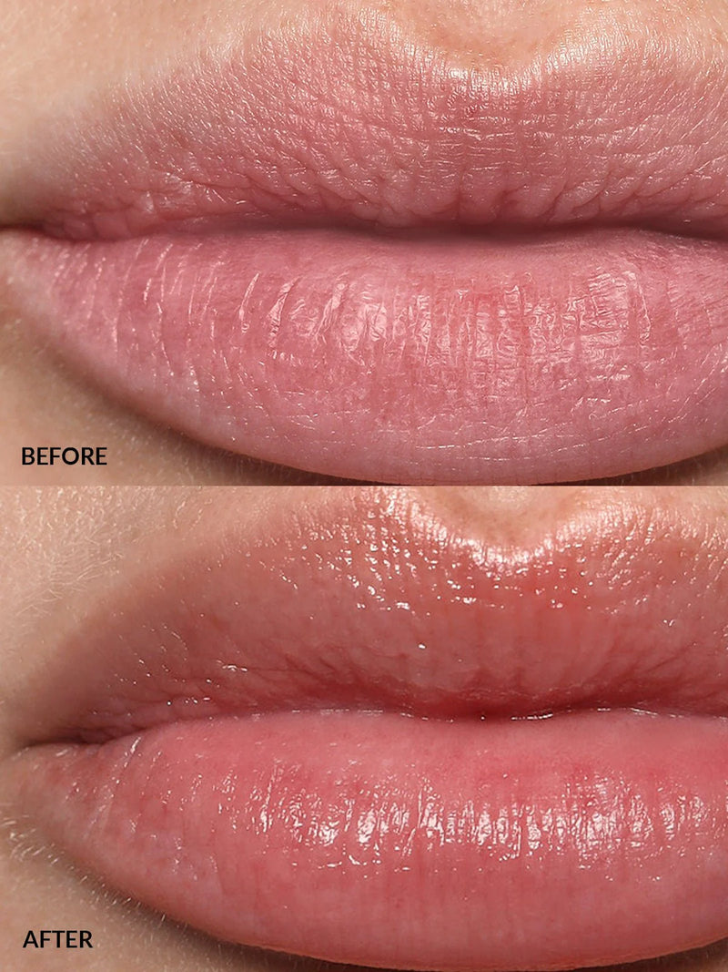 Lip buff - Refy /  Tratamiento rellenador de labios