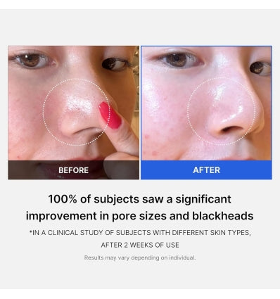 Zero Pore Pads - Medicube / Almohadillas para los poros