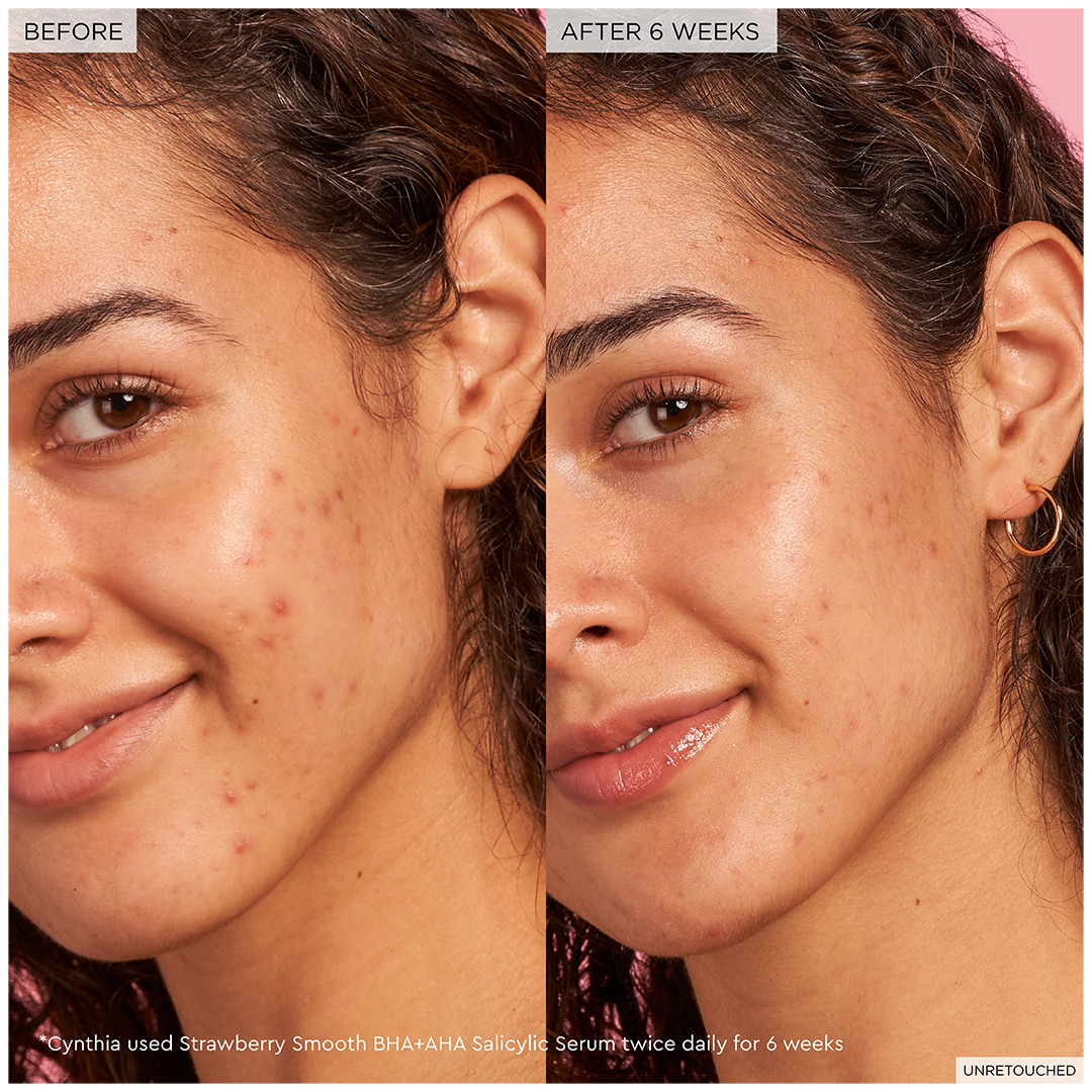 *PREORDEN: Strawberry Smooth BHA + AHA Salicylic Acid Serum - Glow Recipe / Suero AHA y BHA