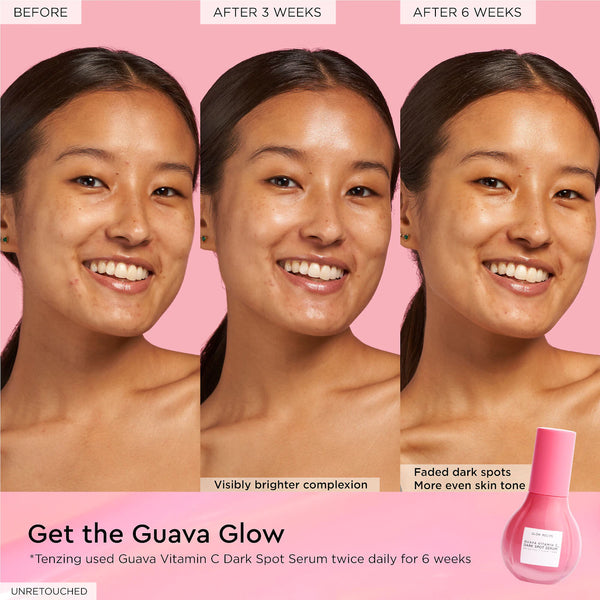 *PREORDEN: Guava Vitamin C Dark Spot Treatment Serum - Glow Recipe / Suero para manchas oscuras