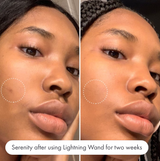 Lightning Wand - Hero / Sérum para manchas post-acné