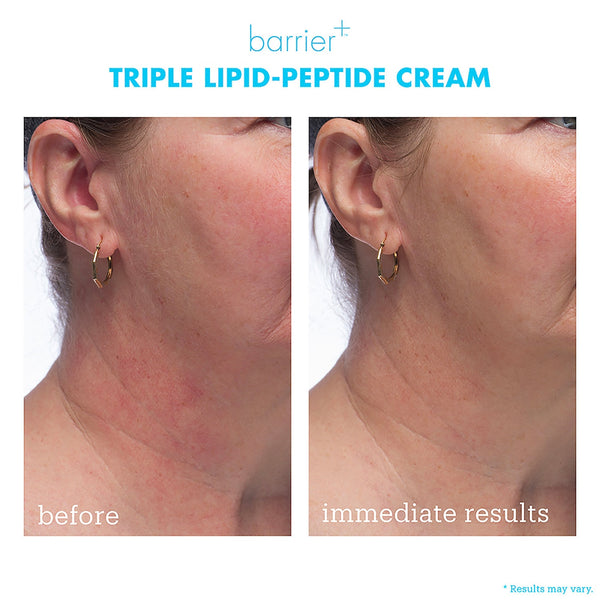 *PREORDEN: Barrier+ Triple Lipid Peptide Face Cream - skinfix / Crema facial de hidratación profunda