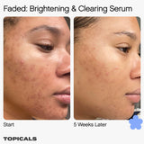 Faded Serum for Dark Spots & Discoloration - Topicals / Suero para hiperpigmentación