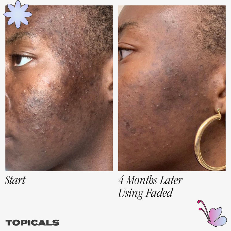 Faded Serum for Dark Spots & Discoloration - Topicals / Suero para hiperpigmentación