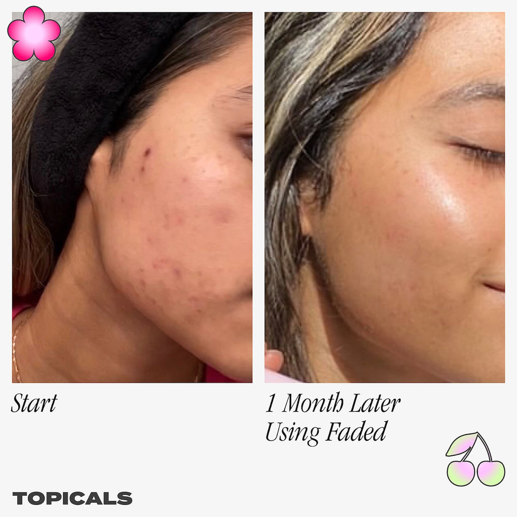 Faded Serum for Dark Spots & Discoloration Topicals / Suero para hip