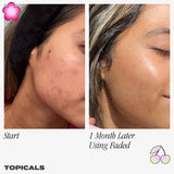 Faded Serum for Dark Spots & Discoloration - Topicals / Suero para hiperpigmentación