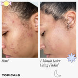 Faded Serum for Dark Spots & Discoloration - Topicals / Suero para hiperpigmentación