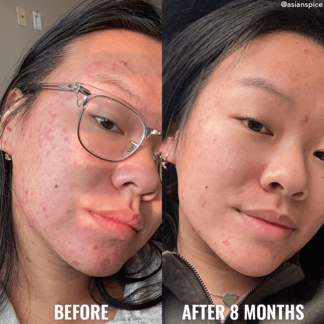 Discoloration Correcting Serum - Good Molecules / Suero para hiperpigmentación