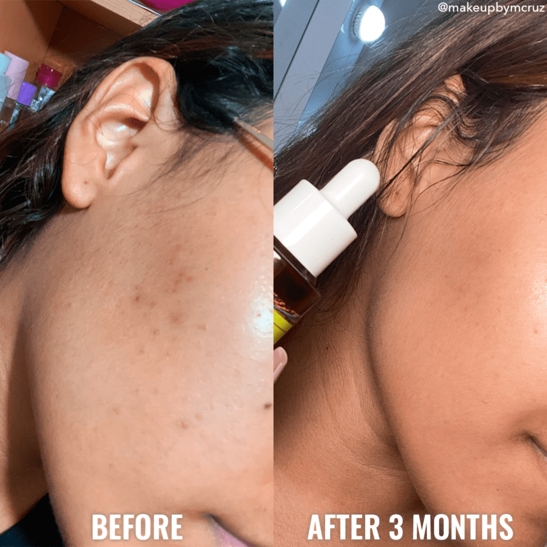 Discoloration Correcting Serum - Good Molecules / Suero para hiperpigmentación