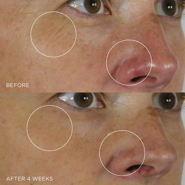 *PREORDEN: The Silk Serum Wrinkle Smoothing Retinol Alternative 30 mL - Tatcha / Serum alternativa retinol - arrugas