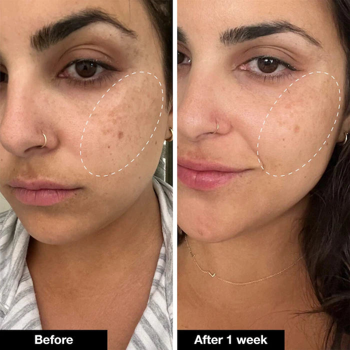 Retinol Remix 1% Retinol Treatment - iNNBEAUTY PROYECT / Arrugas, hiperpigmentación y poros