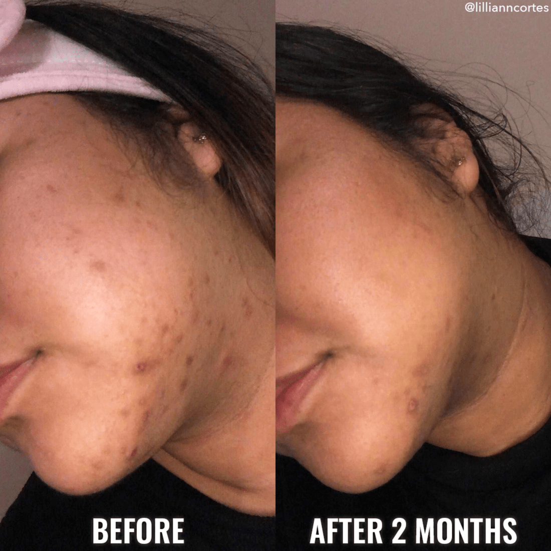 Discoloration Correcting Serum - Good Molecules / Suero para hiperpigmentación