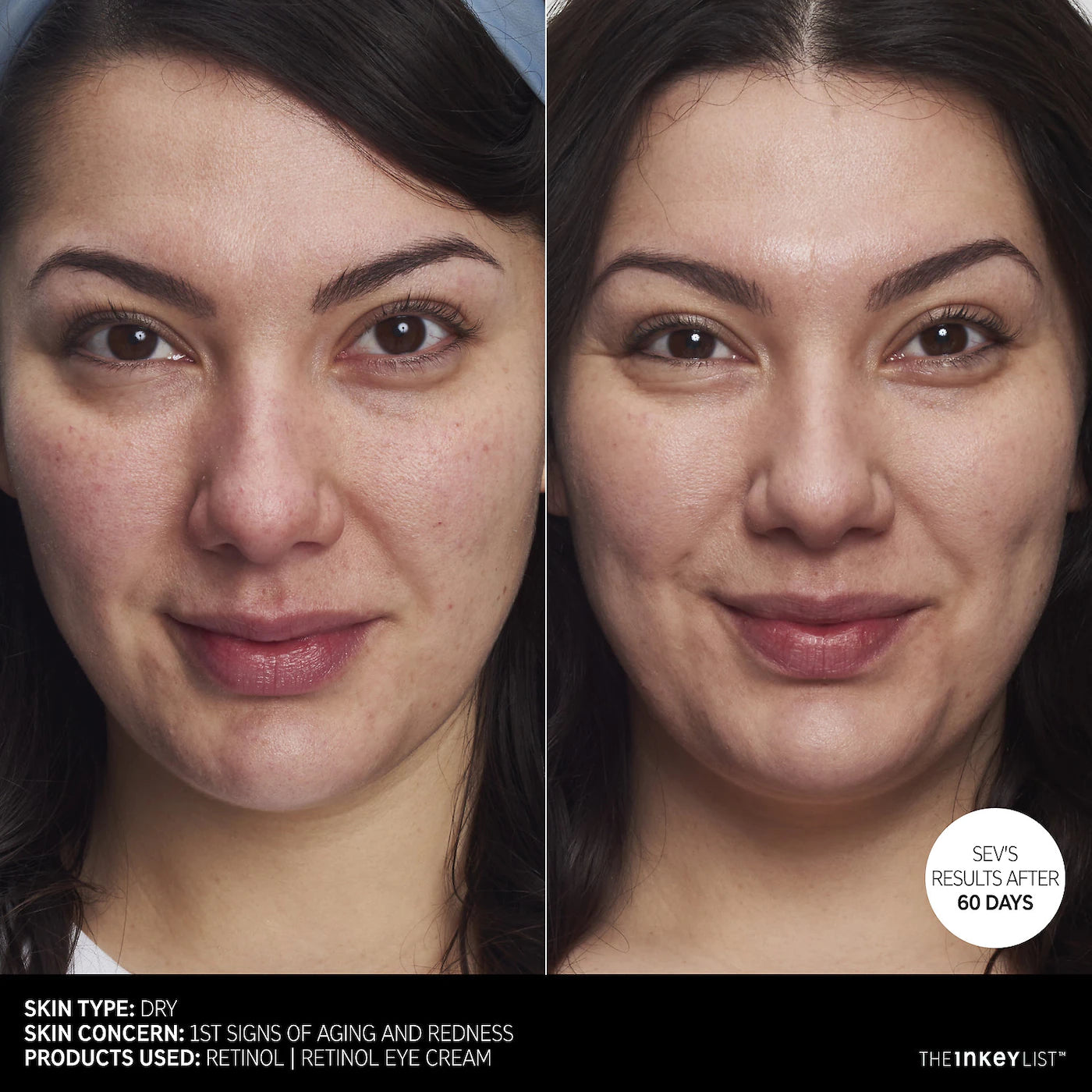 *PREORDEN: Retinol Anti Aging Serum - The Inkey List / Suero soporte antiedad