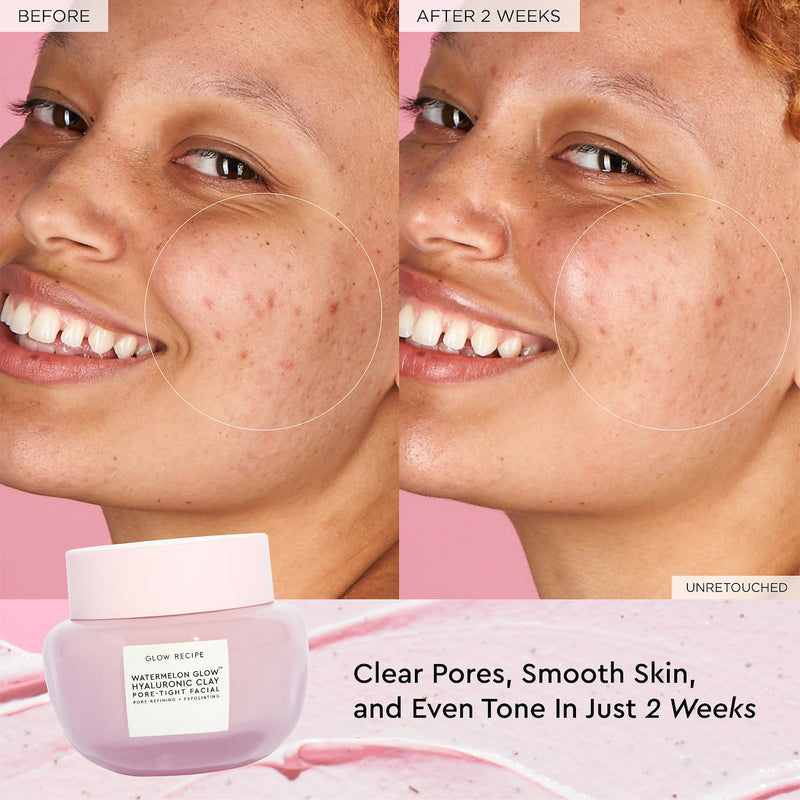 *PREORDEN: Watermelon Glow Hyaluronic Clay Pore Tight Facial Mask - Glow Recipe / Mascarilla poros obstruidos